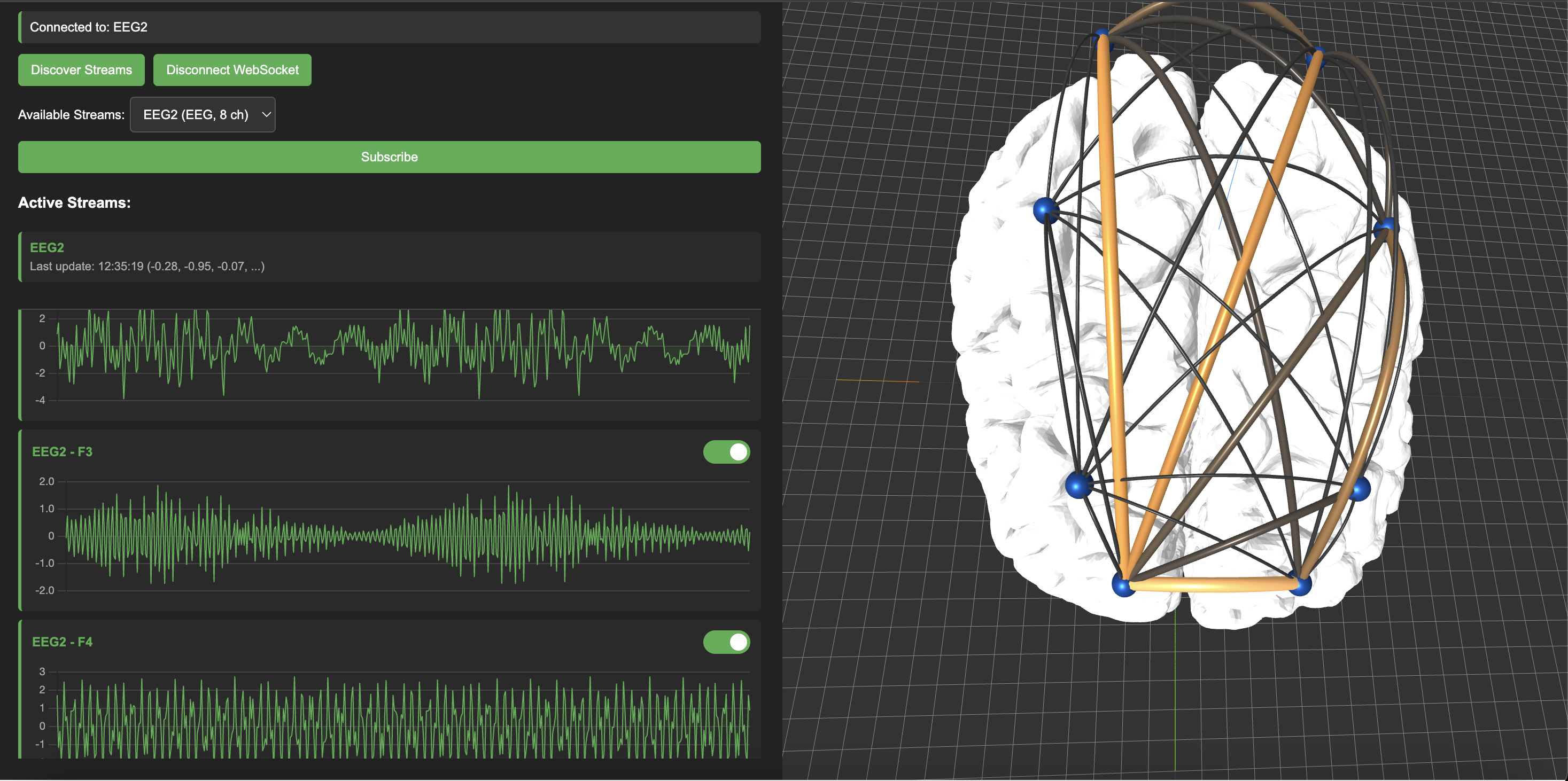 Signal Processing Feature 1