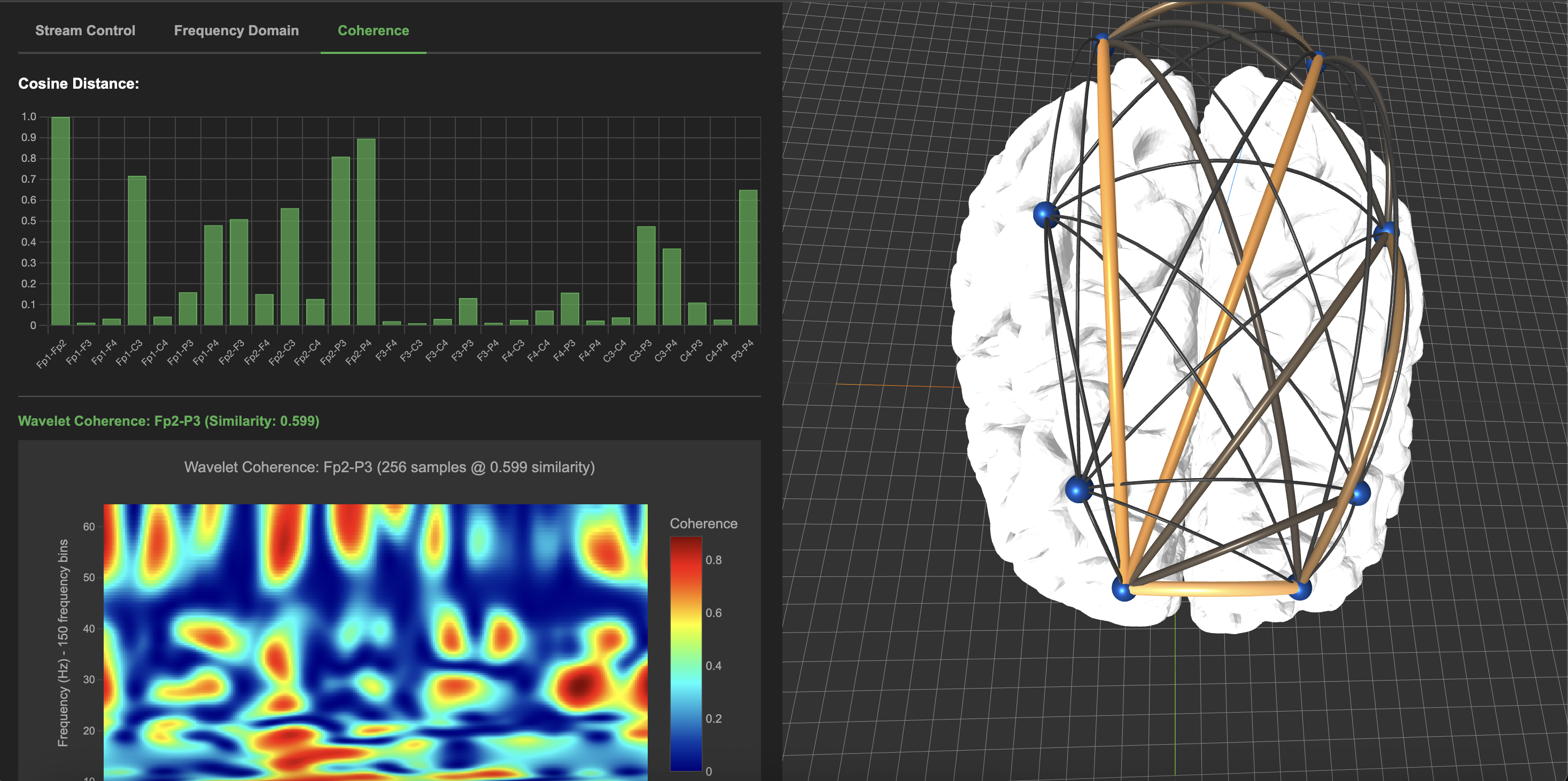 Signal Processing Feature 2